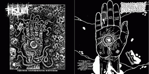 Fistula (USA-1) : Fistula - Radiation Sickness